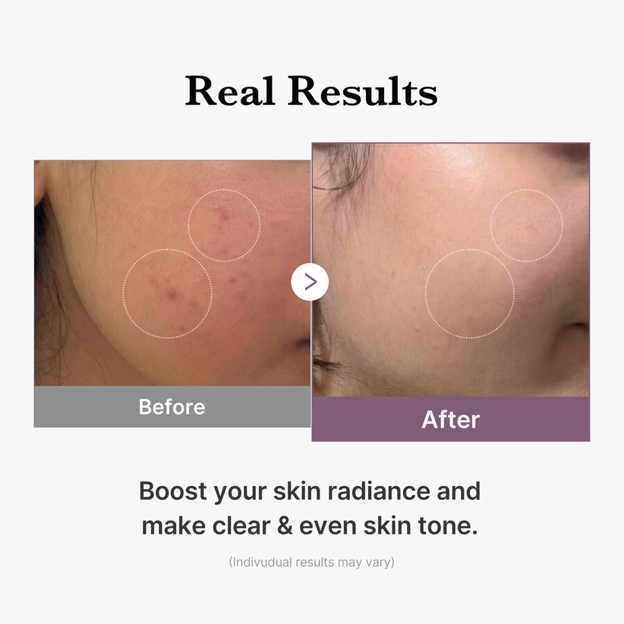 medicube age-r glutathione glow milk toner